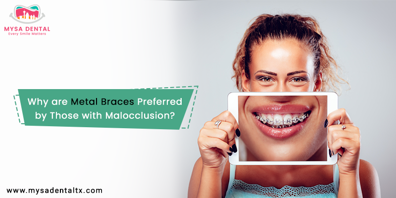 Metal Braces are Best Choice for Malocclusion